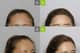Slider image (7) MOAMAN Hair Transplant Aesthetic Restoration Clinic
